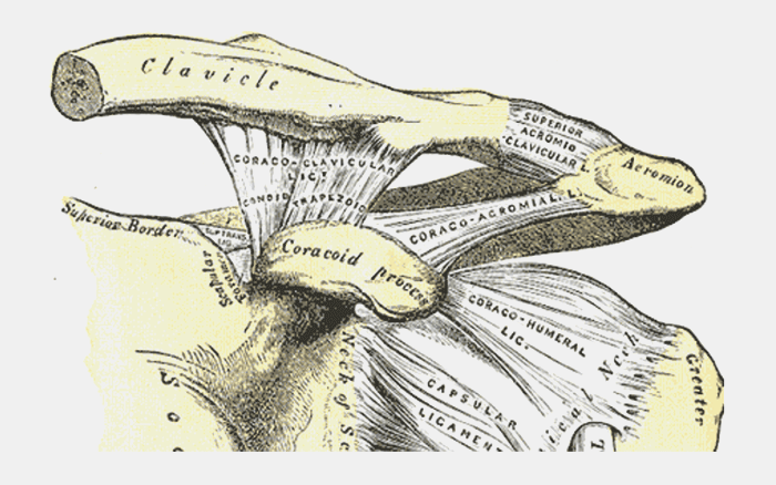 Entorses, luxations, Disjonction acromio-claviculaire